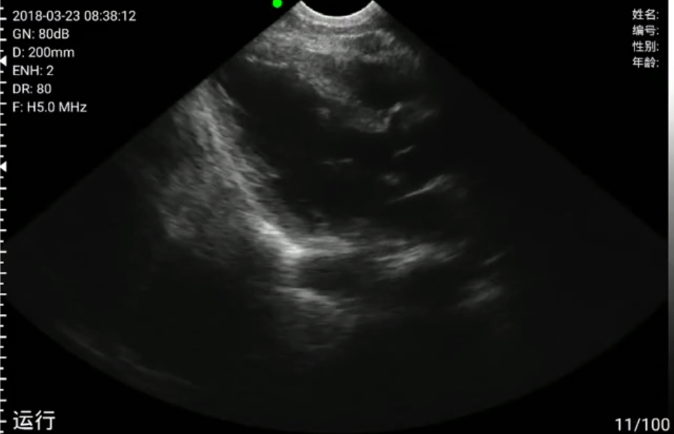 Portable Ultrasound 1