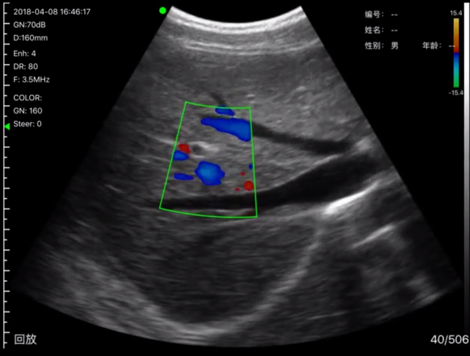 Portable Ultrasound 2