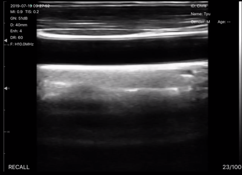Portable Ultrasound 3