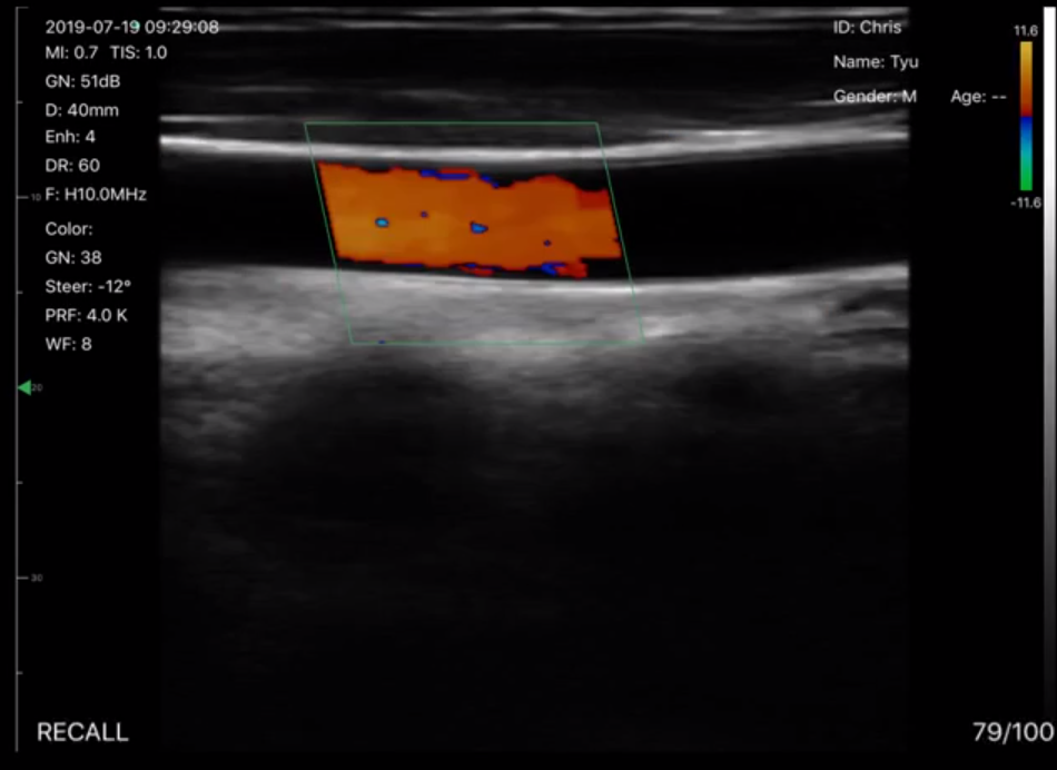 Portable Ultrasound 4